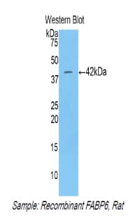 I-BABP / FABP6 Antibody (aa1-128)