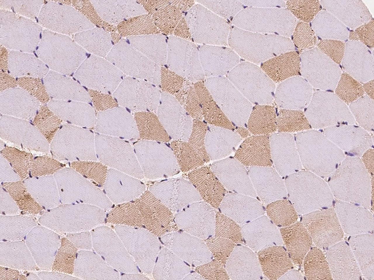 TBCA Antibody