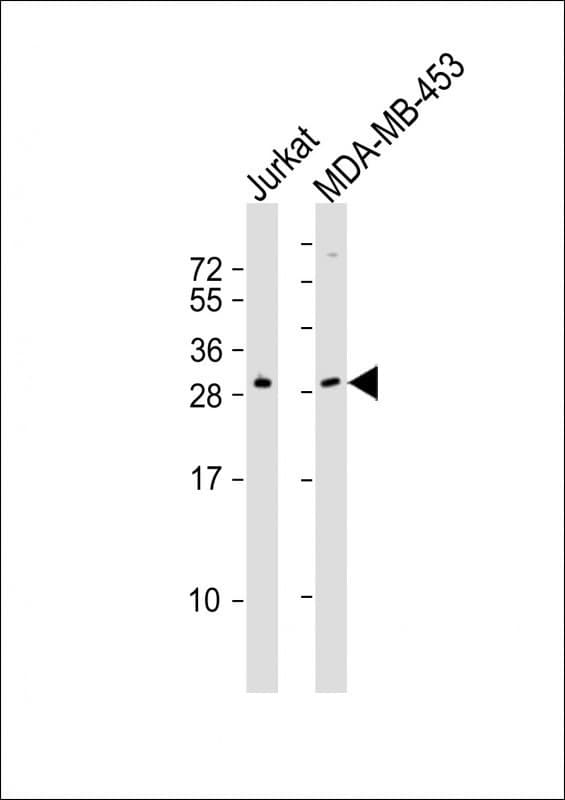 SSX2 Antibody (aa110-142)