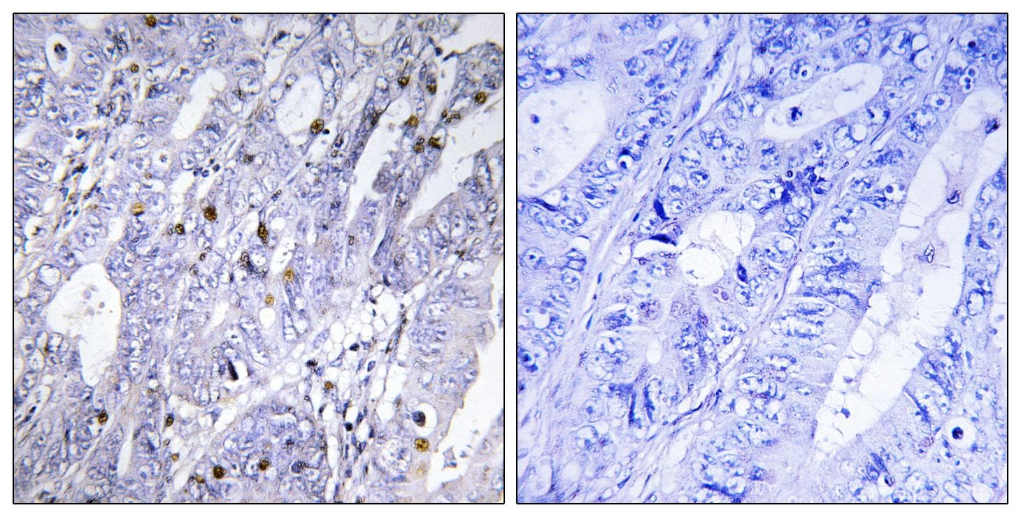 MEF2D Antibody