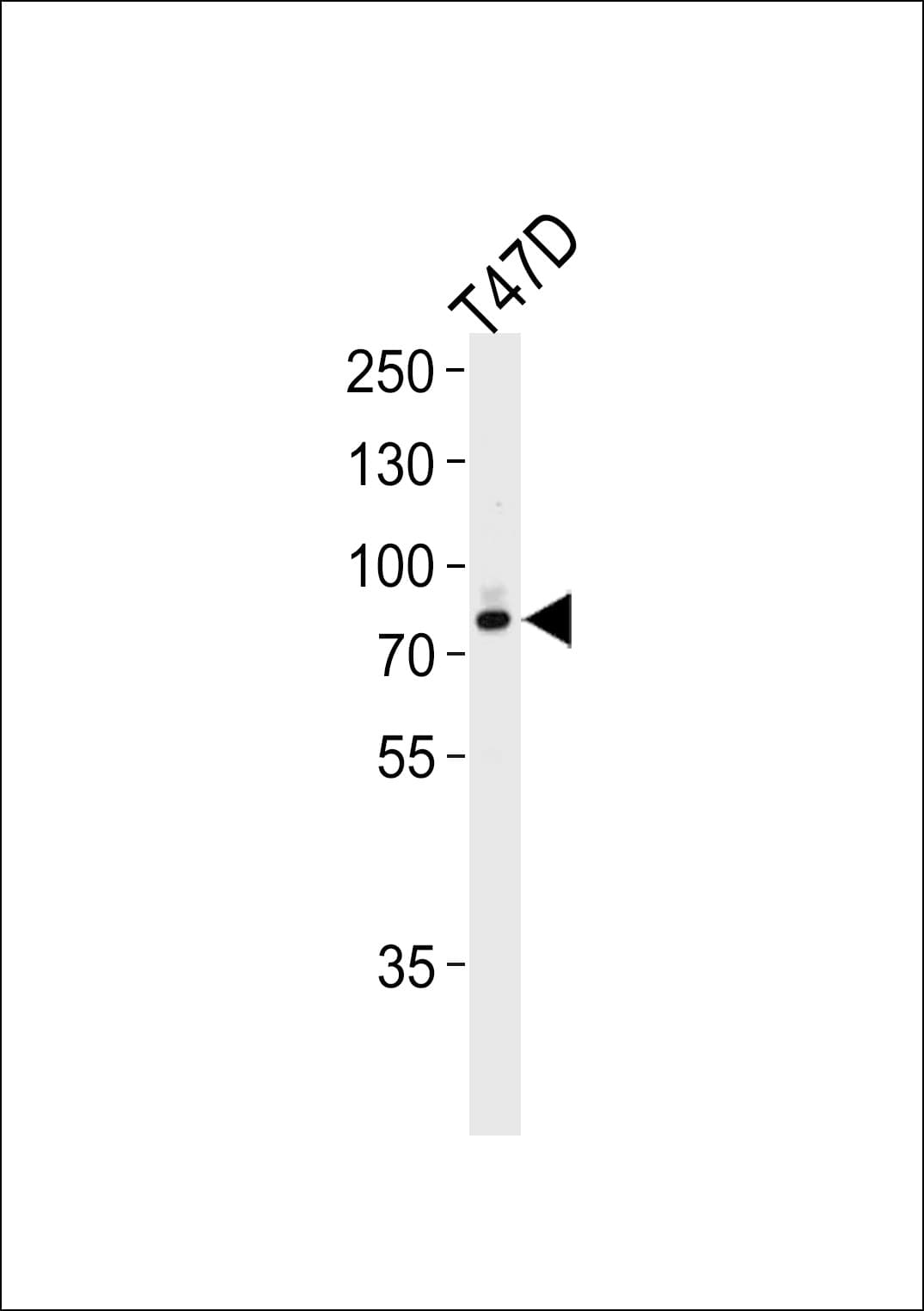 EXT2 Antibody (aa182-209)