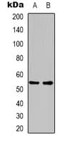 GLP1R / GLP-1 Receptor Antibody