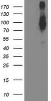 FGFR2 / FGF Receptor 2 Antibody (clone OTI1H5)