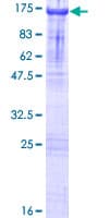 Human ZCCHC8 Protein (Recombinant GST)