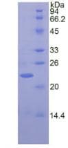 Human Heparan Sulfate Proteoglycan Protein (Recombinant His)