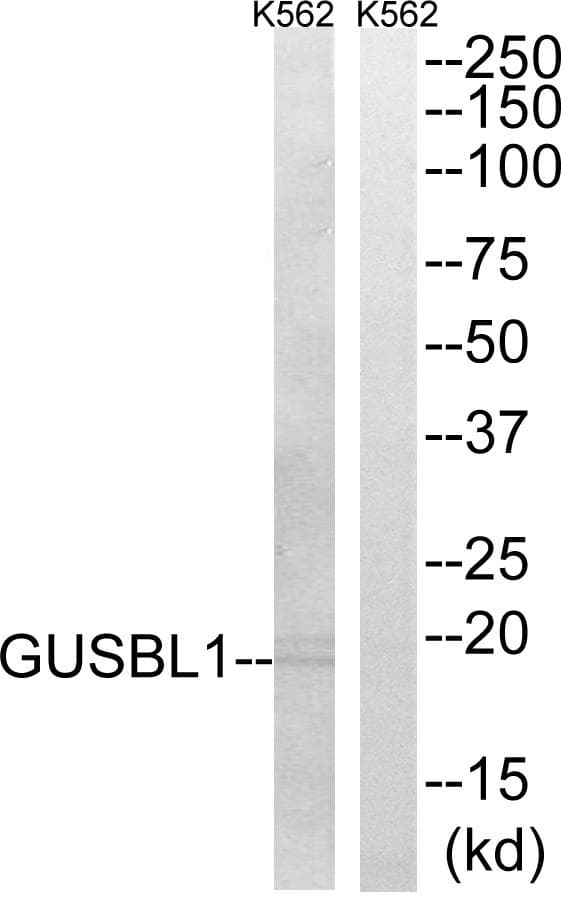 Polyclonal Rabbit anti-Human Sma3 Antibody (IHC, IF, WB)