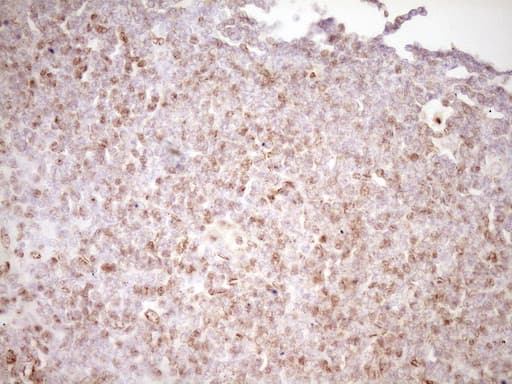 LPIN1 / Lipin 1 Antibody (clone OTI8F10)