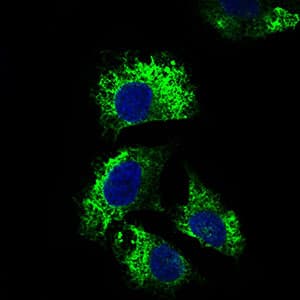 IL2RA / CD25 Antibody (aa34-139, clone 1B5D12)