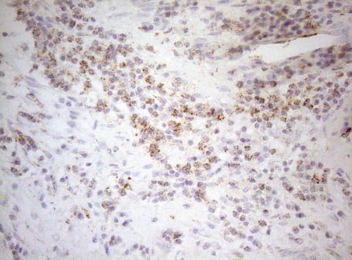 DECR1 Antibody (clone OTI5D12)