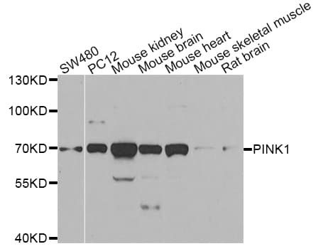 Polyclonal Rabbit anti-Human PINK1 Antibody (IHC, IF, WB)
