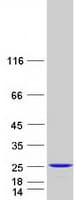 Human RAP2B Protein (Recombinant Myc-DDK (Flag))