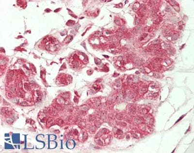 IHC-plus™ Calmodulin Antibody (aa 2-149)