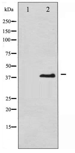 EIF2S1 Antibody (phospho-Ser51)