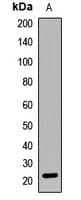 AK1 / Adenylate Kinase 1 Antibody