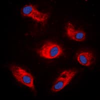 Polyclonal Rabbit anti-Human RPS6KB1 / P70S6K / S6K Antibody (phospho-Ser434, IHC, IF, WB)