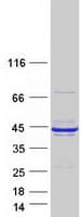 Human RCN1 / Reticulocalbin 1 Protein (Recombinant Myc-DDK (Flag))