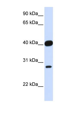 ELK3 / NET Antibody (aa252-301)