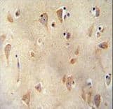 LRRC40 Antibody (aa343-371)
