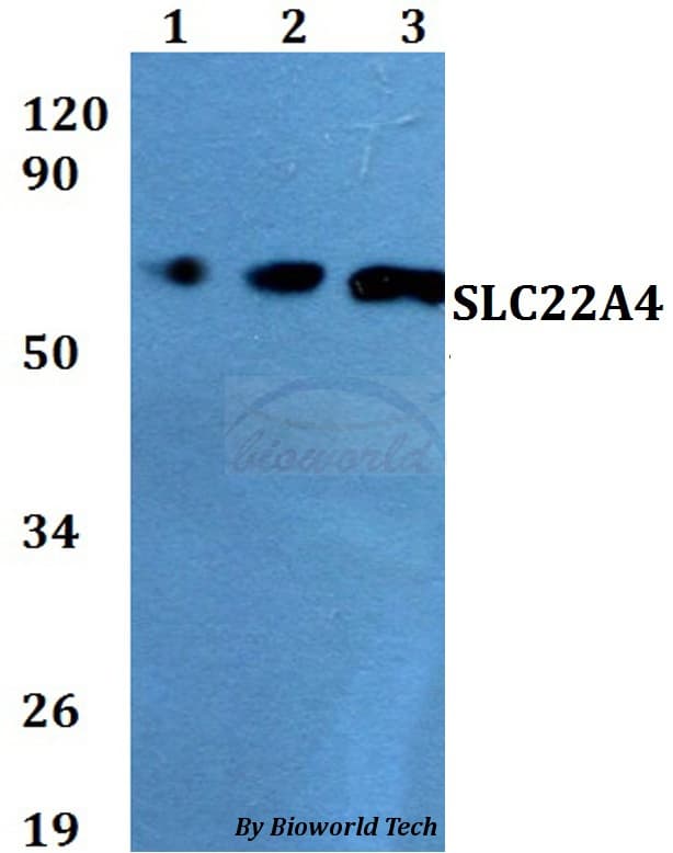 Polyclonal Rabbit anti-Human SLC22A4 / OCTN1 Antibody (WB)