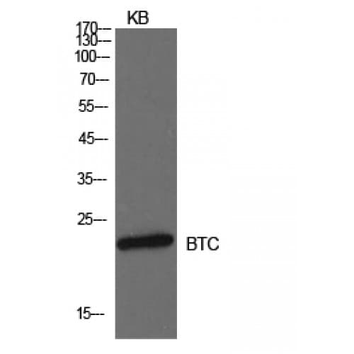 BTC / Betacellulin Antibody (21-70 aa, Internal)
