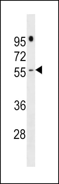 Polyclonal Rabbit anti-Human PRAMEF16 Antibody (aa446-472, WB)