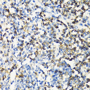 Polyclonal Rabbit anti-Human CD3E Antibody (IHC, IF, WB)