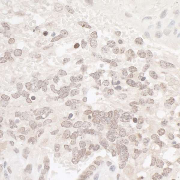 CSNK2A1 Antibody (aa300-350)
