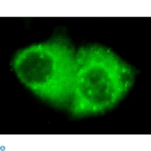 KRT7 / CK7 / Cytokeratin 7 Antibody