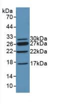 CHD3 Antibody (aa1613-1820)