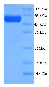 Human SEPT7 / Septin 7 Protein (Recombinant His)
