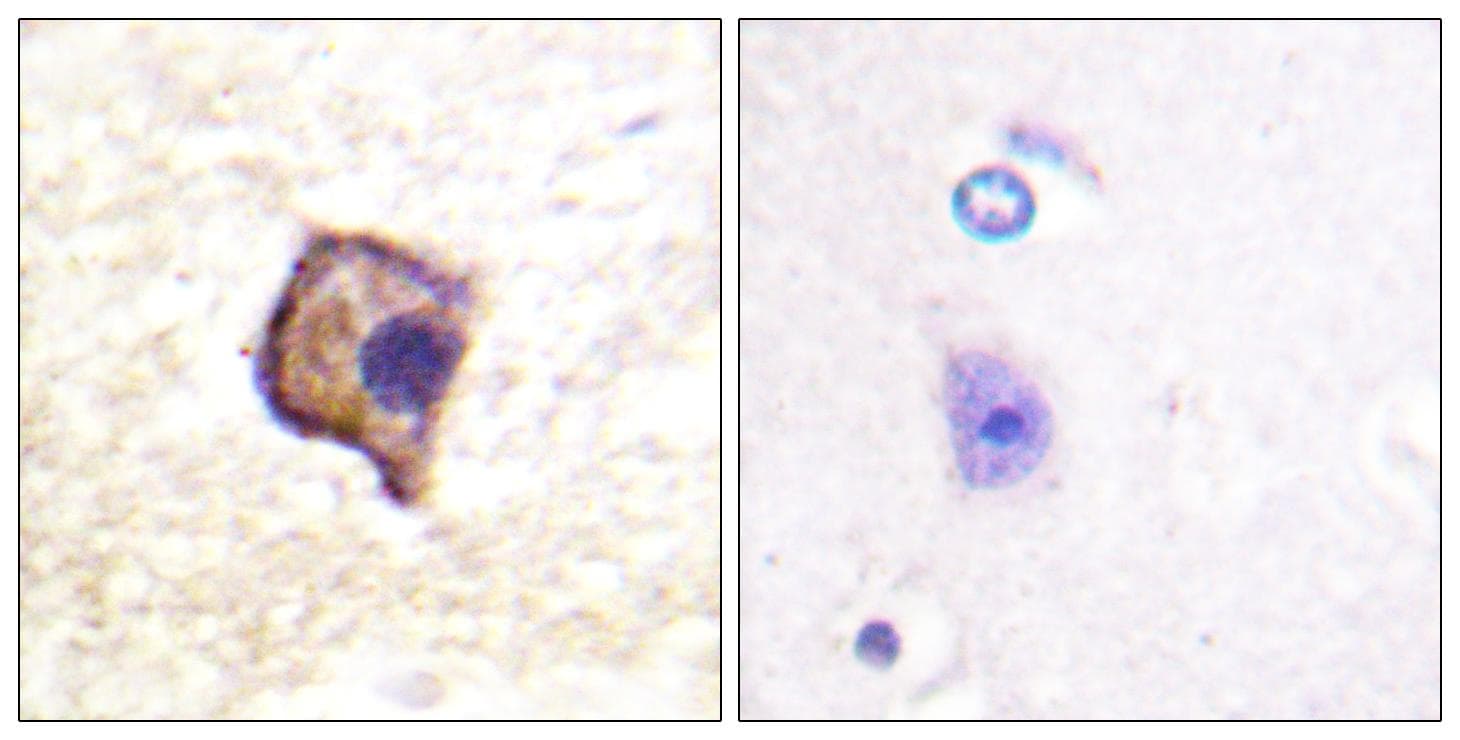 RET Antibody (p905)