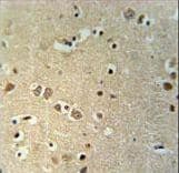 Polyclonal Rabbit anti-Human KCTD21 Antibody (aa232-260, IHC, WB)