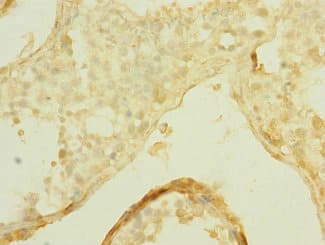 SLCO2B1 Antibody
