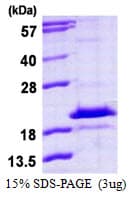Human HDDC3 Protein (Recombinant His)