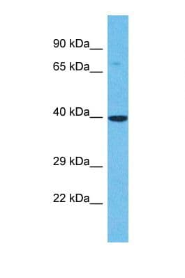 Polyclonal Rabbit anti-Human OR6B3 Antibody (aa227-276, WB)