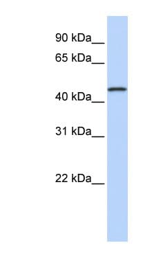 MAGE10 / MAGEA10 Antibody (C-Terminus)