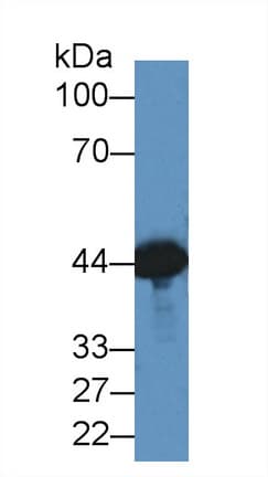 CKM / Creatine Kinase MM Antibody (aa11-367)