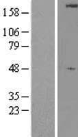 ULK1 Protein (Over-Expression Lysate Myc-DDK (Flag))