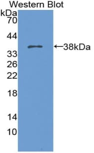 ARG2 / Arginase 2 Antibody (aa23-354, APC)