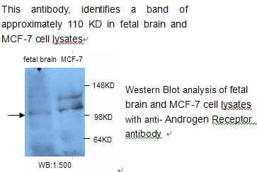 AR / Androgen Receptor Antibody