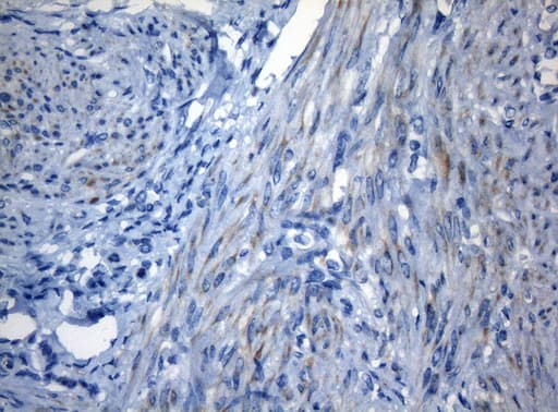 ZNF394 Antibody (aa1-296, clone OTI1G9, Carrier-free)
