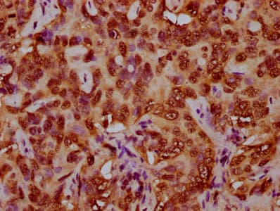 HIST1H4I Antibody
