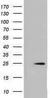 Monoclonal Mouse anti-Human MOBKL2B / MOB3B Antibody (clone OTI6E3, IF, WB)