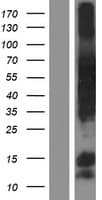 SPDL1 / CCDC99 Protein (Over-Expression Lysate Myc-DDK (Flag))