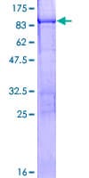 Human KRT76 / Keratin 76 Protein (Recombinant GST)