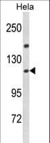 IPO11 / Importin 11 Antibody (aa56-85)