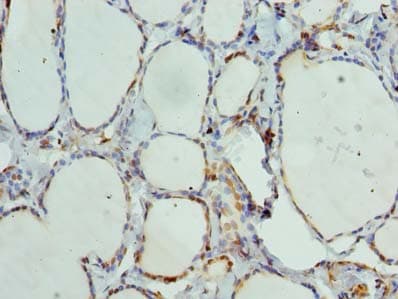 ANKMY1 Antibody