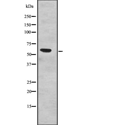 Polyclonal Rabbit anti-Human SF3A3 / SF3a60 Antibody (WB)