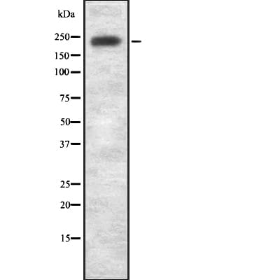 Polyclonal Rabbit anti-Human LRRK1 Antibody (IHC, WB)