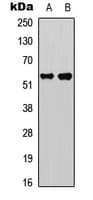 CASP8 / Caspase 8 Antibody (Internal)